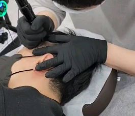 동래두피문신 모발이식 MiLDO_SMP